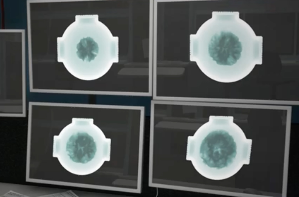 Accel Radiographs