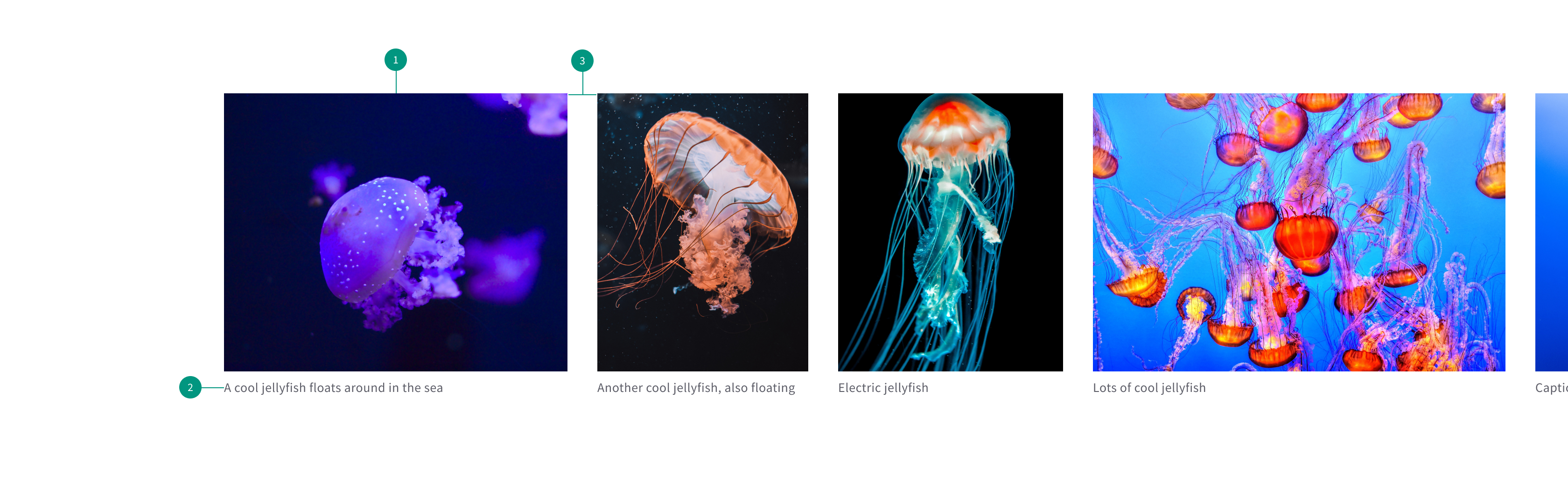 Gallery Anatomy