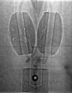 Asterix Phase Contrast Imaging